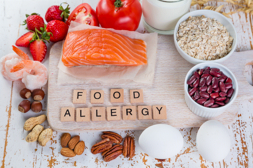 Fundamentals of Food Allergy
